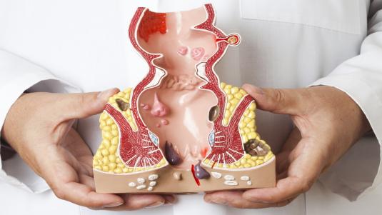 الحكّة الشّرجيّة.. دراسة طبية شاملة عن الأسباب والأعراض والعلاج